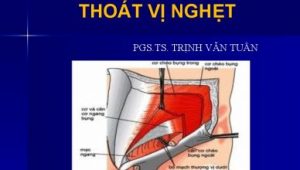 Anh 01 Sep. 22 21.55 388x220