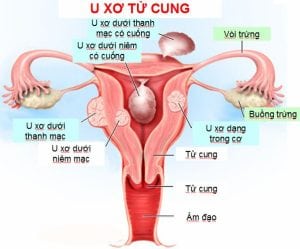 U xo tu cung