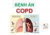 Bệnh án bệnh phổi tắc nghẽn mãn tính (COPD)