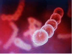 Viêm cầu thận cấp sau nhiễm liên cầu