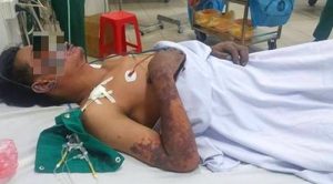 24 Phác đồ điều trị sốc nhiễm khuẩn