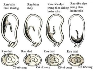 24 rau tien dao
