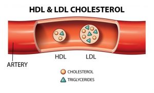 23 Rối Loạn Lipid Máu – Phác Đồ Bộ Y Tế, Rối loạn chuyển hóa lipid