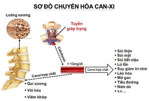 Tăng Calci Máu (Chẩn đoán và Điều trị)