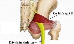 thần kinh ngồi