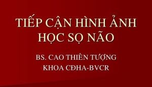 Hình ảnh học sọ não