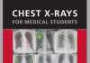 Chest X-Ray For Medical Students PDF Tiếng Việt - Sách Dịch