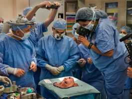 Đằng sau ca phẫu thuật ghép mặt lịch sử dài 31 giờ, Các bác sĩ mất 16 giờ để thực hiện công đoạn cắt phần mặt của người hiến tặng.
