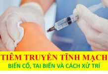 Truyền tĩnh mạch: Những biến cố, tai biến và cách xử trí.
