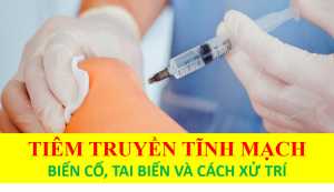 Truyền tĩnh mạch: Những biến cố, tai biến và cách xử trí.