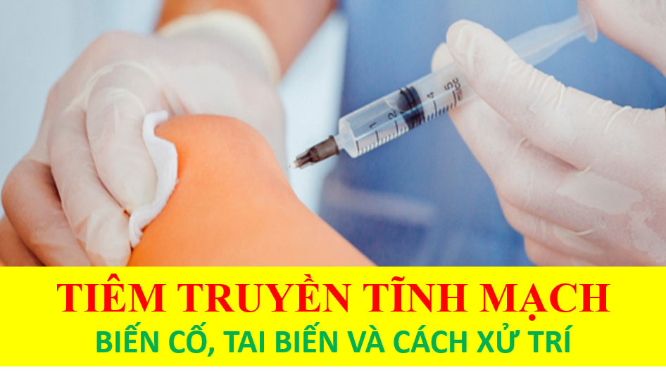 Truyền tĩnh mạch: Những biến cố, tai biến và cách xử trí.