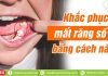 Khắc phục mất răng số 6 bằng cách nào?